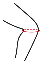 1) Наденьте ортез на ногу