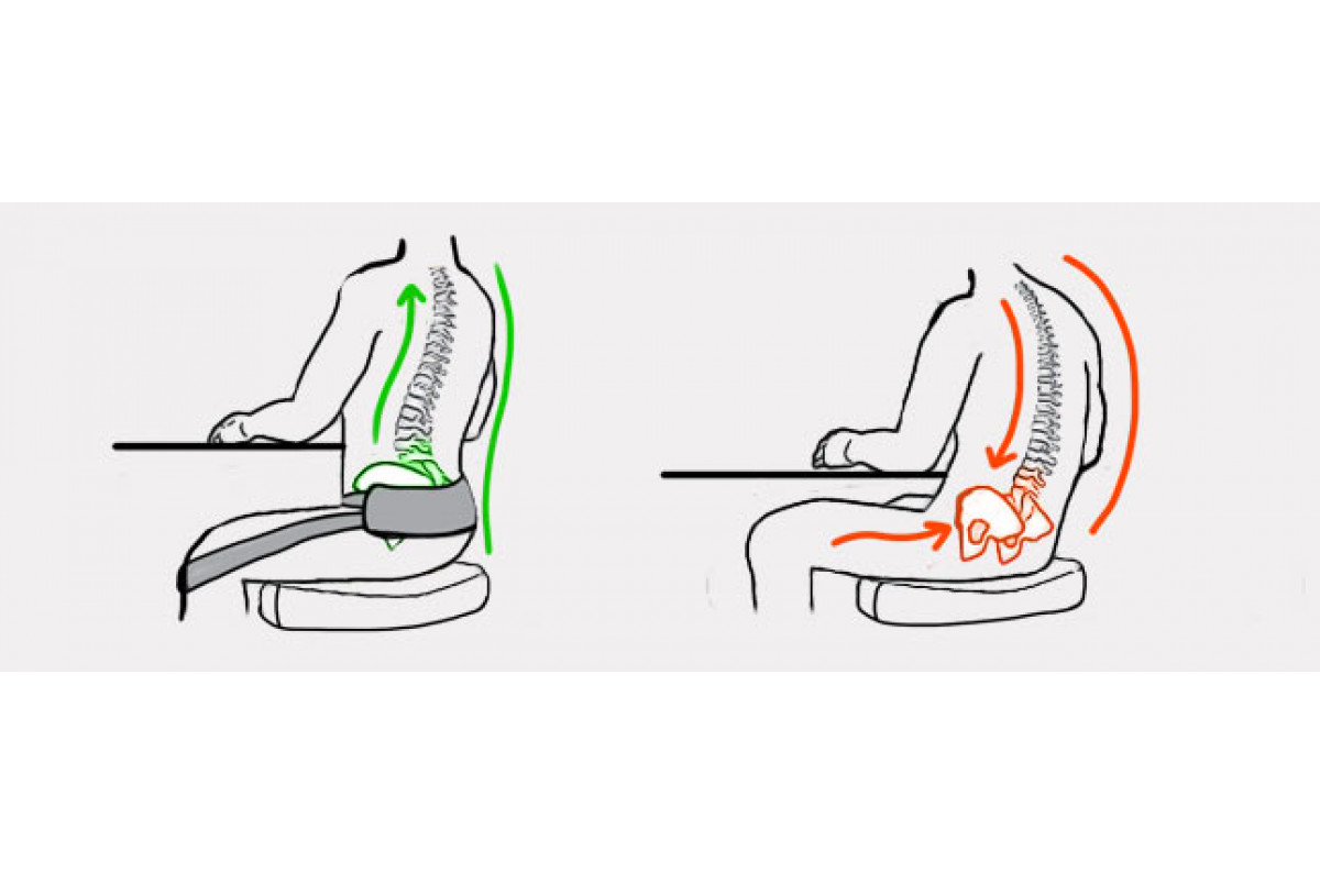 ортез удерживает таз в природном положении с наклоном вперед
