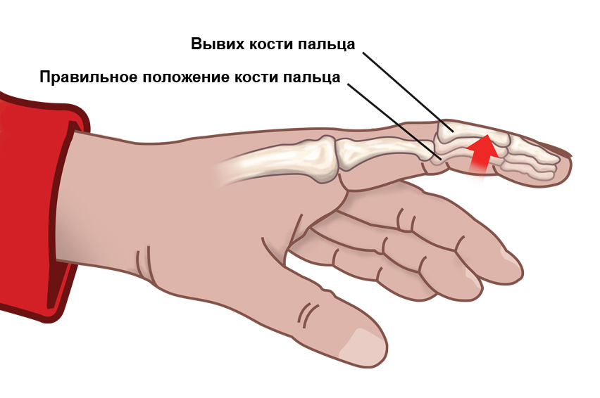 Травмы сустава пальца руки: лечение в Москве